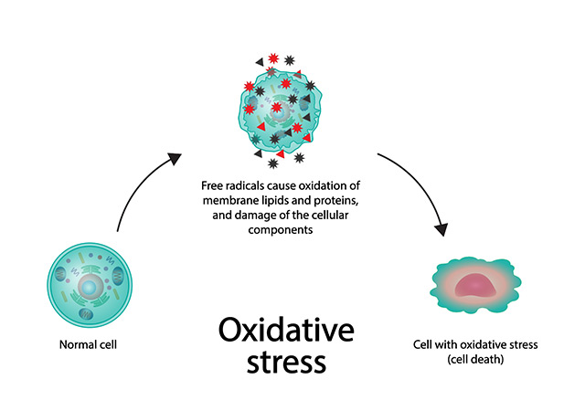 Oxidative-Stress-Part-1 Oxidative-Stress-Part-1